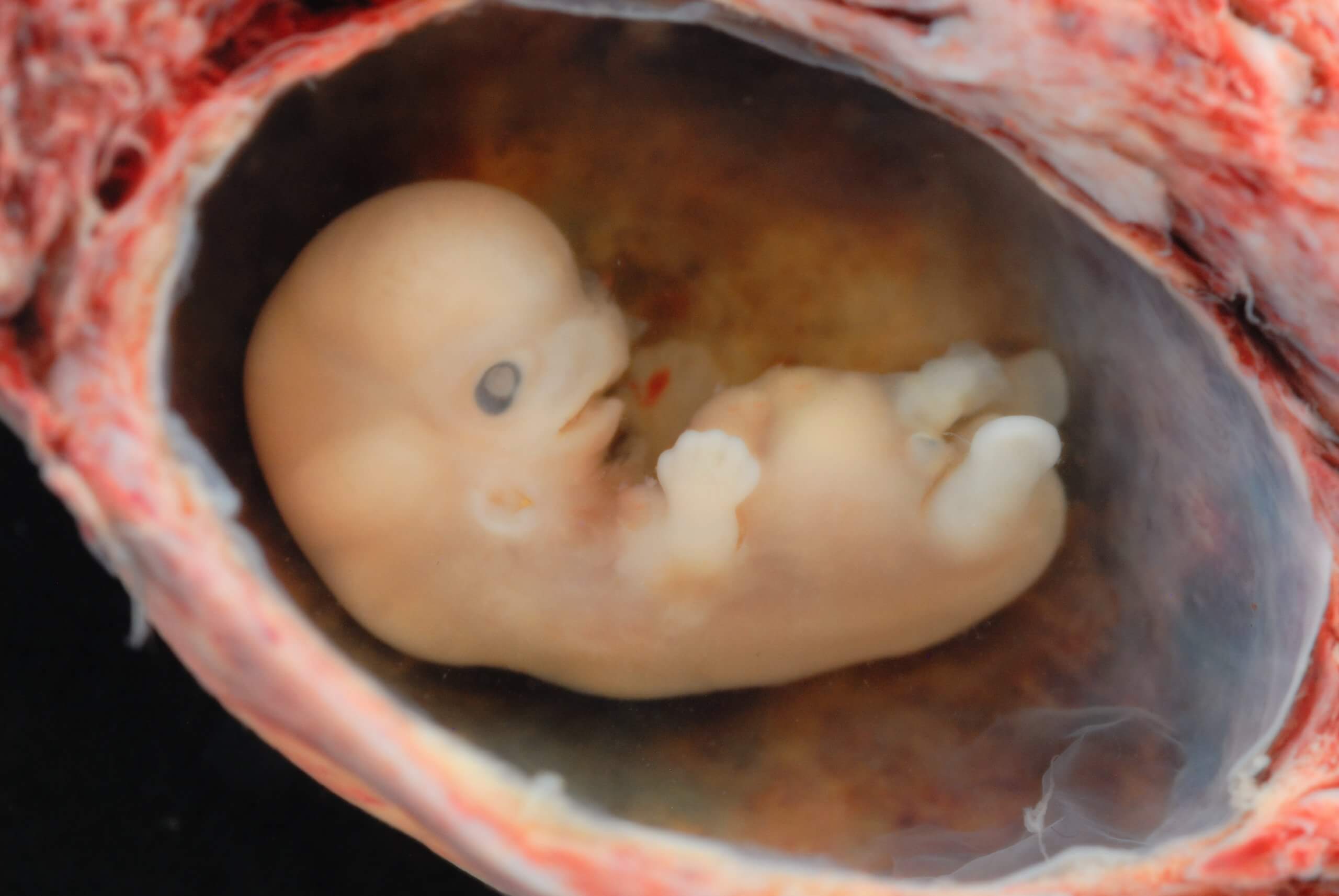 Embryo at 8 weeks