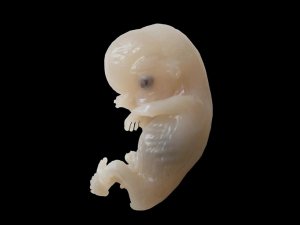 human zygote conception